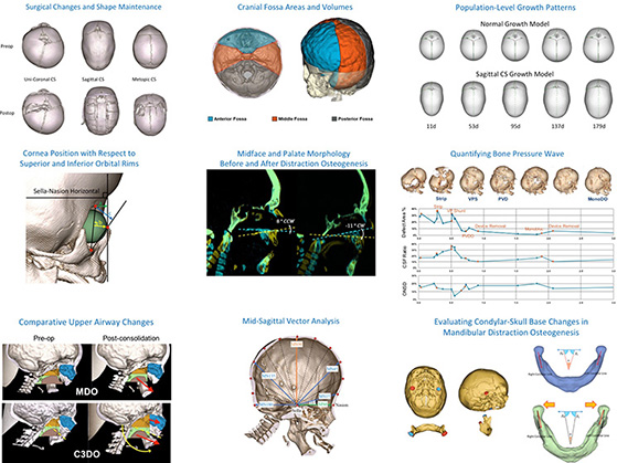 Craniofacial-Image-Analysis-Laboratory 2